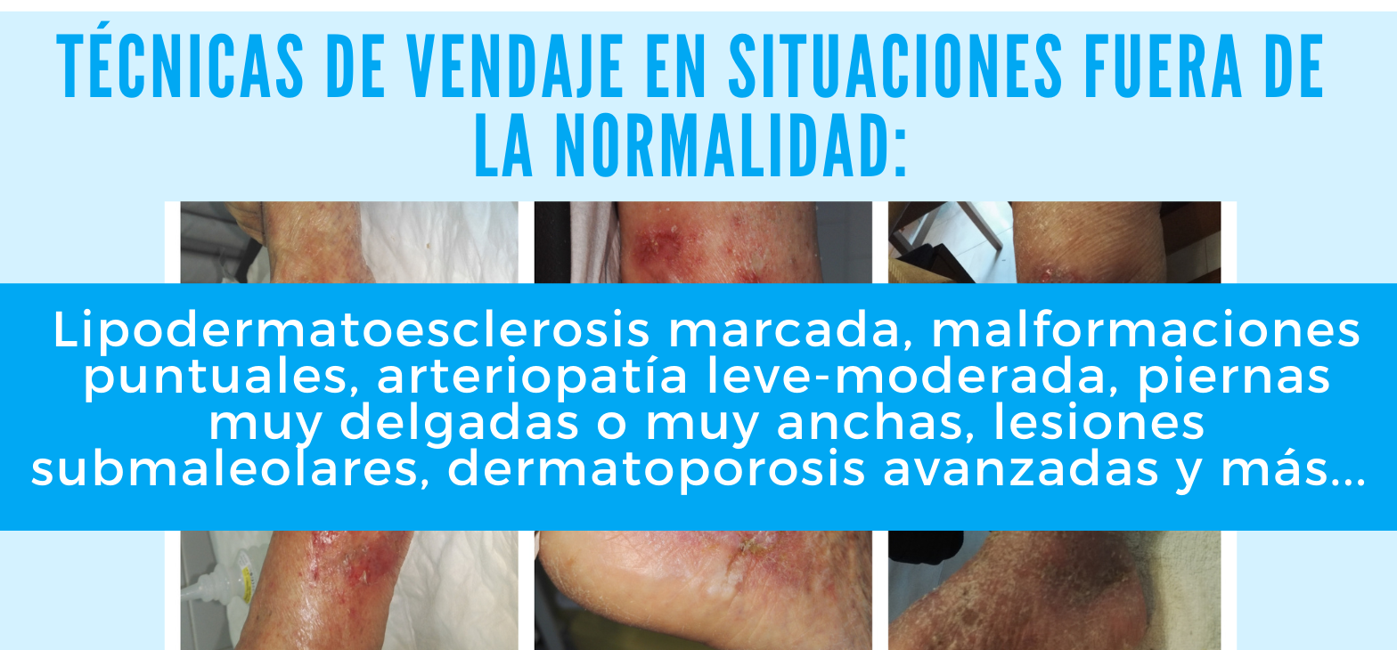 2a MICROFORMACIÓN – Técnicas de vendaje en situaciones fuera de la normalidad