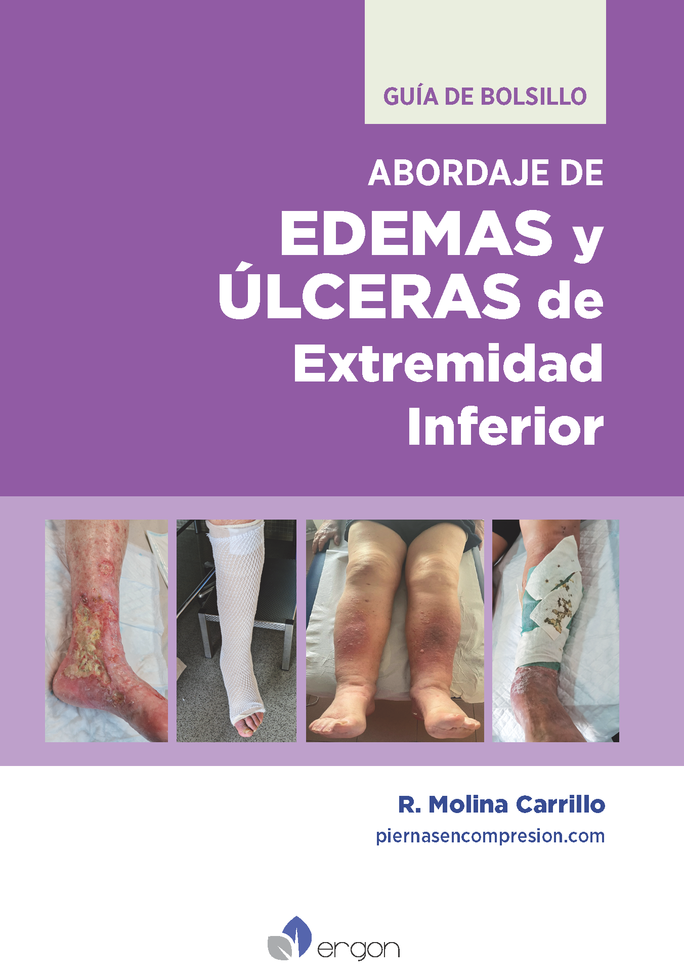 9788419230966-cub-Abordaje de edemas y ulceras de extremidad inferior